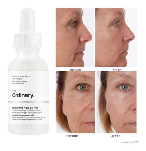 Serum Acido hialuronico 2%+ B5 30 ml