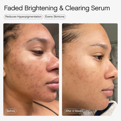 Mini Faded Serum for Dark Spots & Discoloration 15 ml